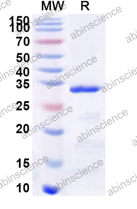 Human TBKBP1 Recombinant Protein (N-GST & C-His)