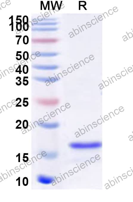 Human ZNF217 Recombinant Protein (N-His)
