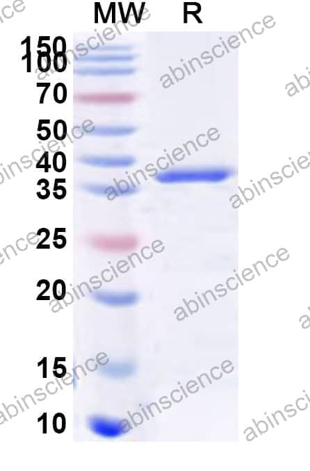 Human GPR137B Recombinant Protein (N-GST & C-His)