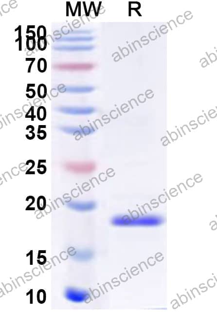 Human ZG16 Recombinant Protein (N-His)