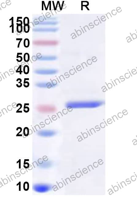 Human CLIC3 Recombinant Protein (N-His)