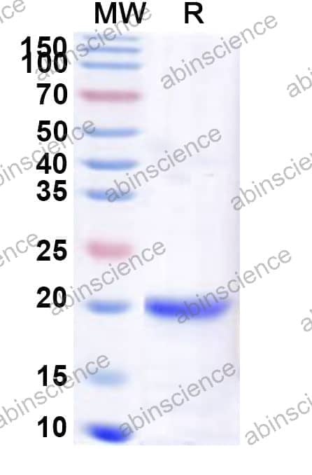 Human ZBED1 Recombinant Protein (N-His)