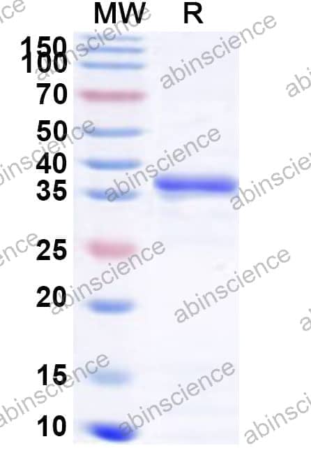 Human GNAI2 Recombinant Protein (N-His)