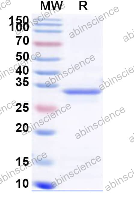 Human SBK3 Recombinant Protein (N-His)