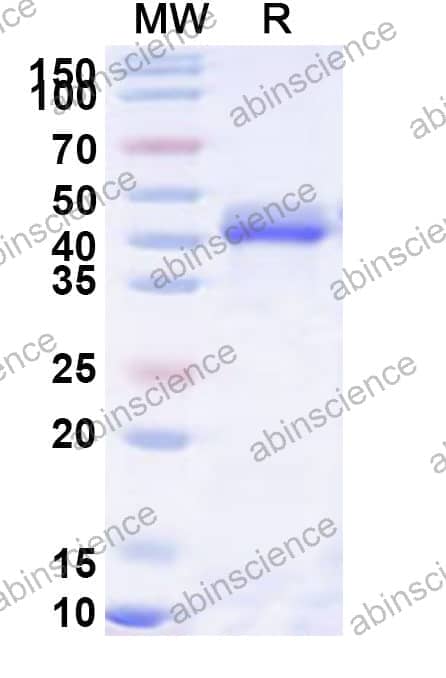 Human CORO1C Recombinant Protein (N-His)