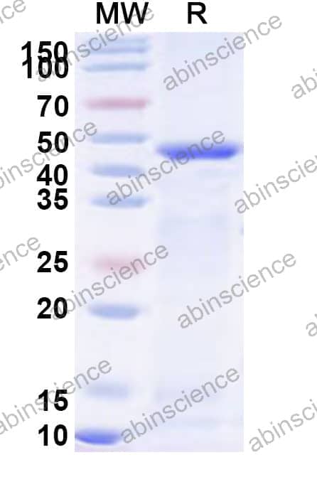 Human ATG4B Recombinant Protein (N-His)