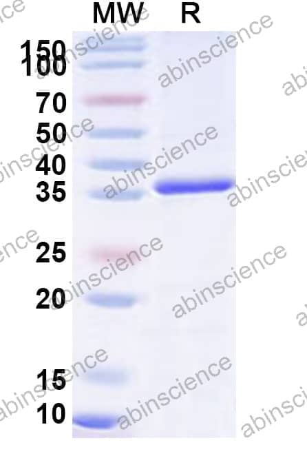 Human VPS26A Recombinant Protein (N-His)