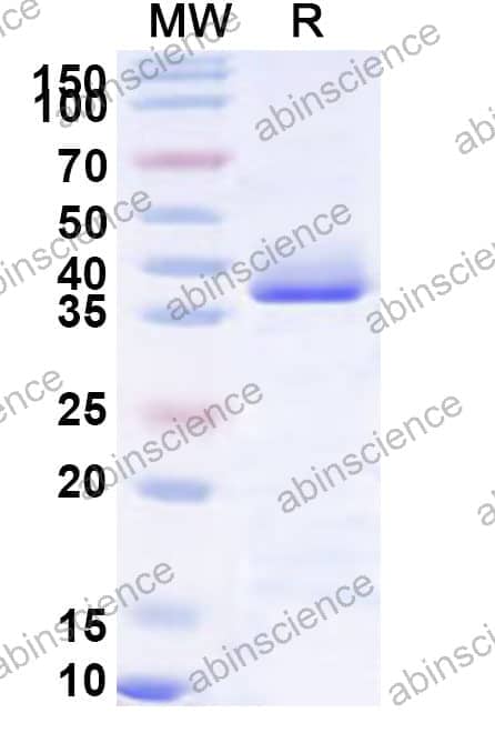 Human MARK1 Recombinant Protein (N-His)