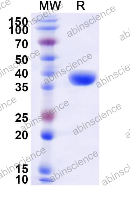 Human CD59 Recombinant Protein (N-GST & C-His)