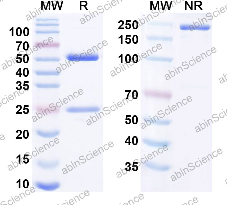Anti-Human CD35 Monoclonal Antibody (1A628)