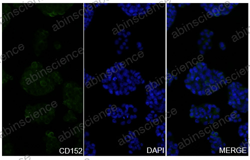 Anti-Human CTLA-4 Recombinant Nanobody (SAA1054)