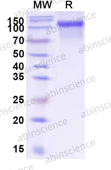 Recombinant Human CD333/FGFR3 Protein, C-Fc