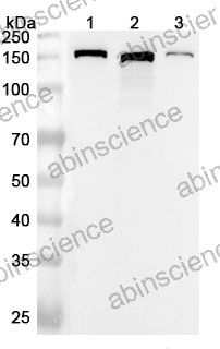 Anti-Human PLCG1 Polyclonal Antibody