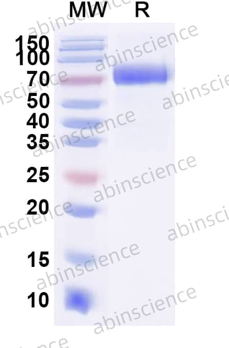 Monkey CD38 Recombinant Protein (C-Fc)