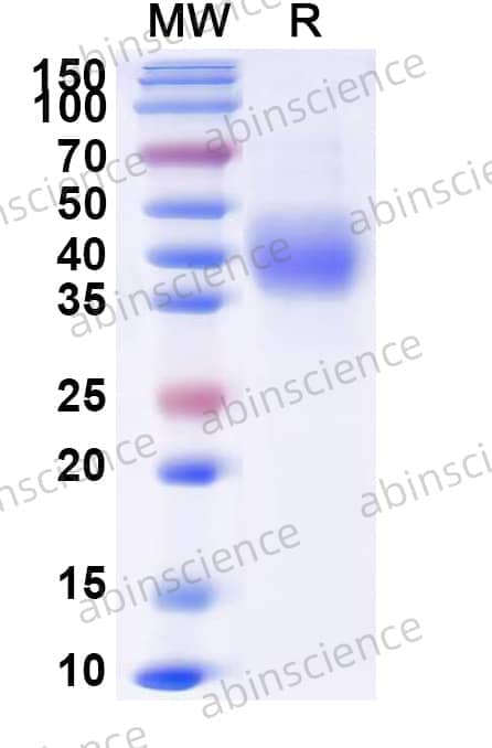 Monkey CD38 Recombinant Protein (C-His)