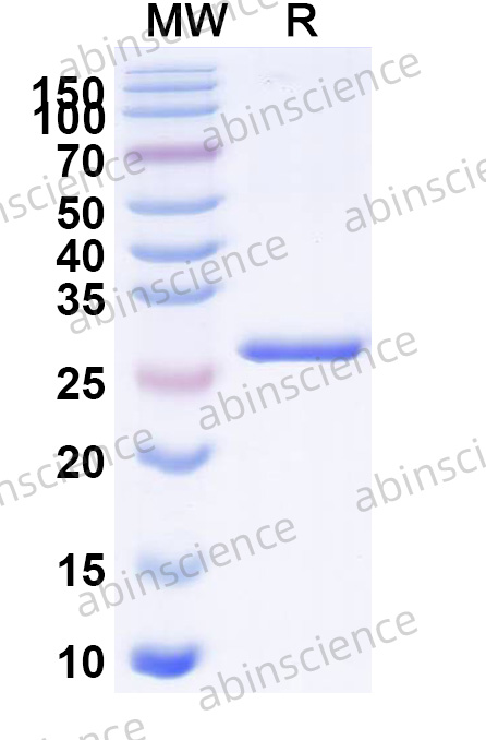 Anti-Human CD38/ADPRC1 Antibody (SAA2540)