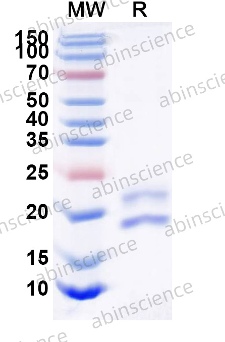 Anti-Human CD123/IL3RA Recombinant Nanobody, C-Sortase tag (SAA1297)
