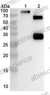 Anti-Huamn IL-3R alpha/CD123 & NKp46/NCR1 Reference Antibody (Bexatamig, RUO)