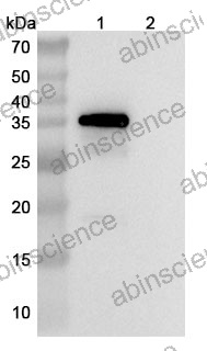 Anti-Human ADCYAP1/PACAP Reference Antibody (Vipalanebart, RUO)
