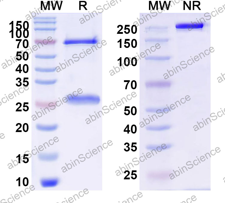 Anti-Human SLC6A4 Monoclonal Antibody (1A665)