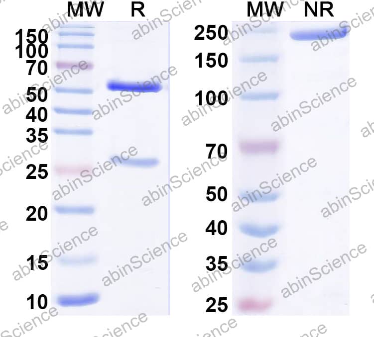 Anti-Human S100A4 Recombinant Antibody (5C3)