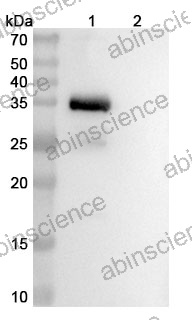 Anti-Human S100A4 Reference Antibody (AX-202, RUO)