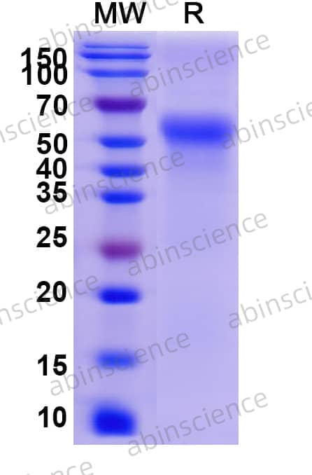 Human CD46 Recombinant Protein (C-His)