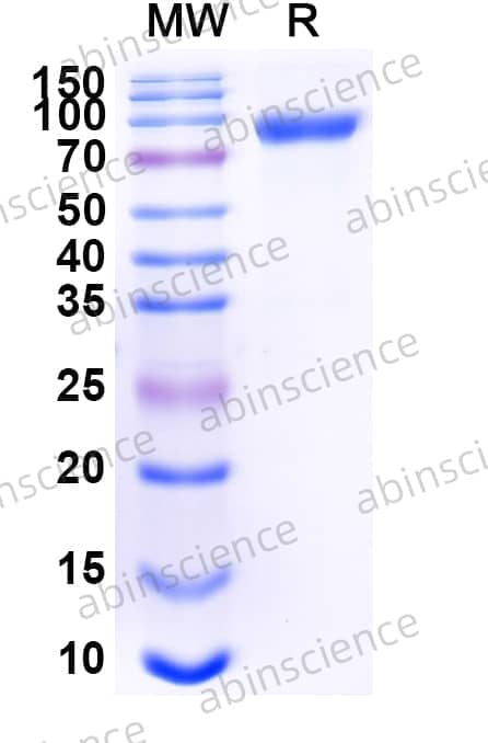 Human CD46 Recombinant Protein (C-Fc)