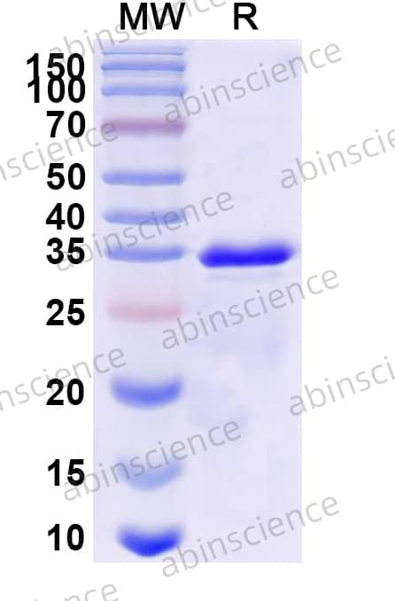 Human TRIM21/RO52 Recombinant Protein (N-His)