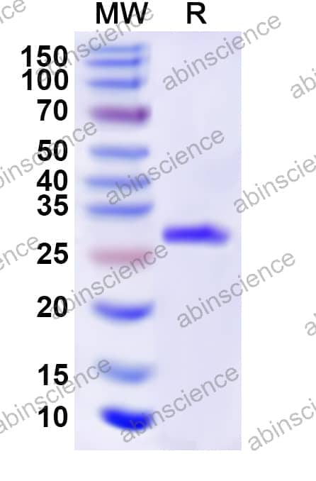Human GABRA5 Recombinant Protein (N-His)