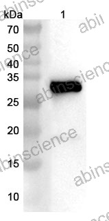 Anti-Human CD40/TNFRSF5 & MSLN Bispecific Reference Antibody (Inezetamab, RUO)