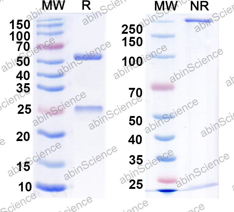 Anti-Human CD27 Ligand/TNFSF7/CD70 Monoclonal Antibody (1A686)