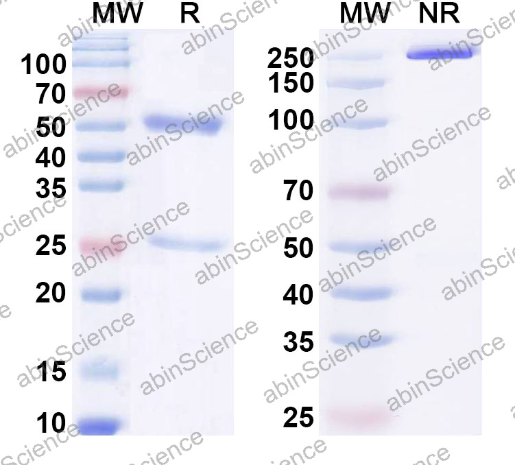 Anti-Human CD27 Ligand/TNFSF7/CD70 Monoclonal Antibody (1A687)
