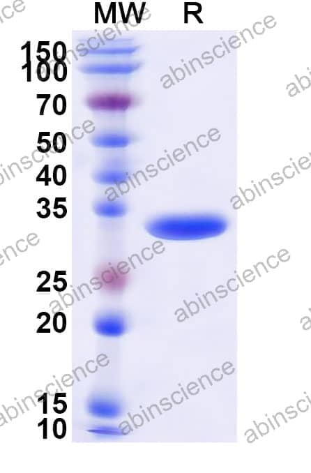 Human EDNRA Recombinant Protein (N-GST&C-His)
