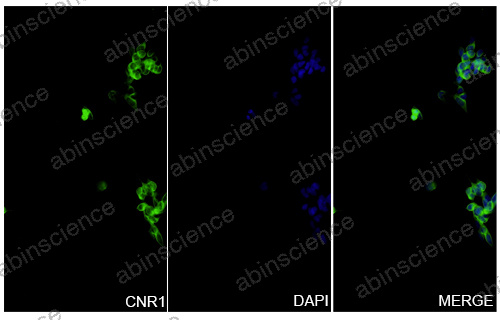 InVivoMAb Anti-Human Cannabinoid R1/CB1/CNR1 Antibody (5D12)