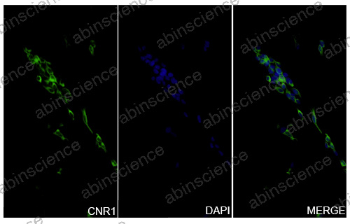 Anti-Human Cannabinoid R1/CB1/CNR1 Recombinant Nanobody (SAA1274)