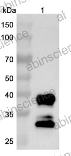 Anti-Human CNR1/CB1 Nanobody (SAA1274)