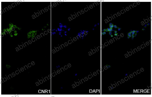 InVivoMAb Anti-Human Cannabinoid R1/CB1/CNR1 Antibody (5G11)