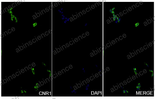 InVivoMAb Anti-Human Cannabinoid R1/CB1/CNR1 Antibody (6B7)