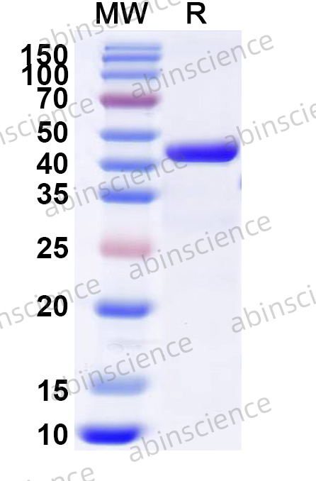 Human GFAP Recombinant Protein (N-His)