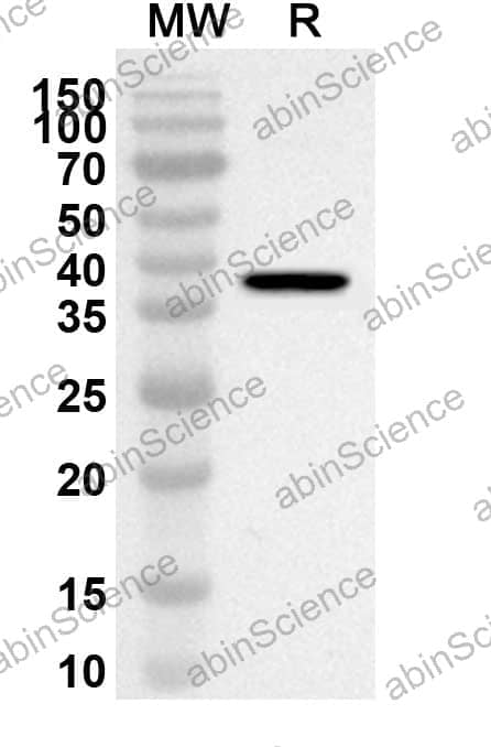 Anti-Human FSHR Polyclonal Antibody