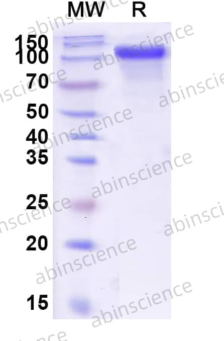 Recombinant Human CD334/FGFR4 Protein, C-Fc