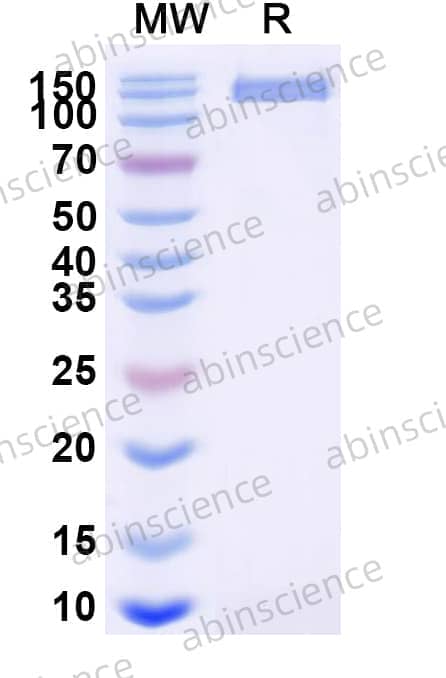 Human N-Cadherin Recombinant Protein (C-Fc)