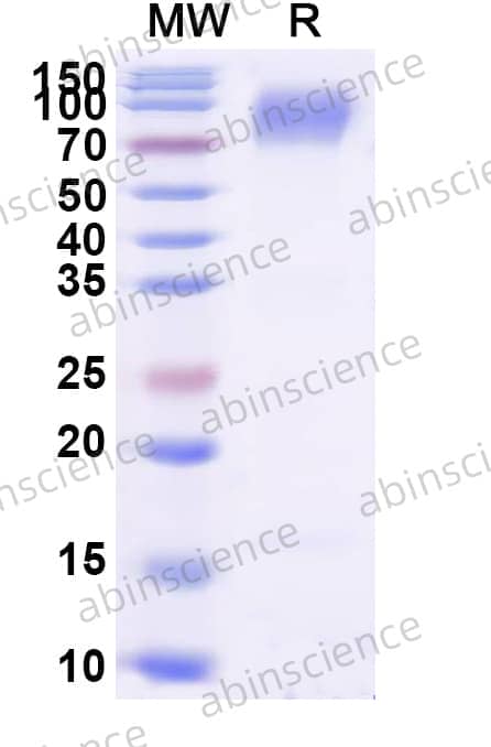 Human CD66a/CEACAM1 Recombinant Protein (C-Fc)