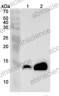 Anti-CRABP2 Polyclonal Antibody