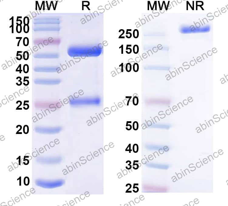 Anti-Human CD191/CCR1 Recombinant Antibody (SAA2405)