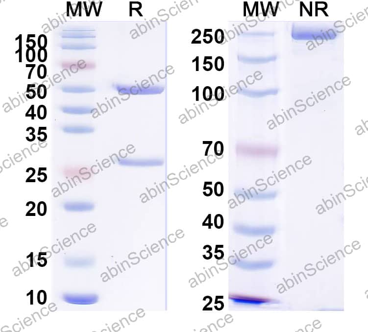 Anti-Human/Mouse CD191/CCR1 Recombinant Antibody (SAA2407)