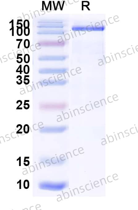 Human CD21/CR2 Recombinant Protein (C-His)