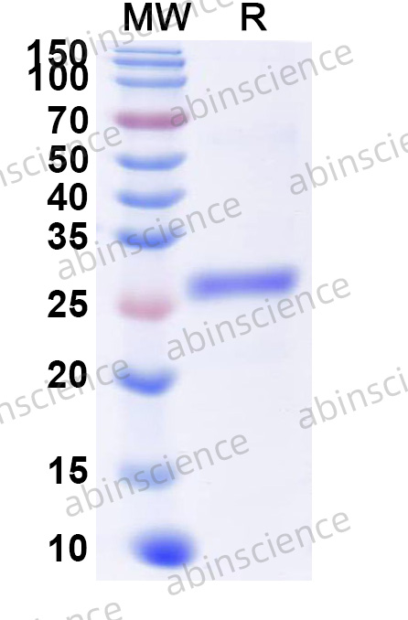 Human CD21/CR2 Recombinant Protein (N-His)