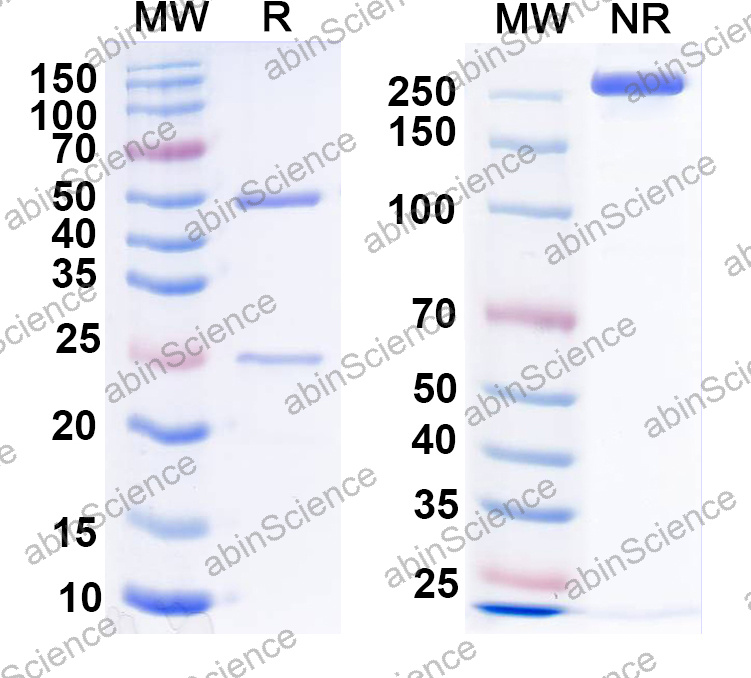 Anti-Human CD21/CR2 Monoclonal Antibody (1A616)